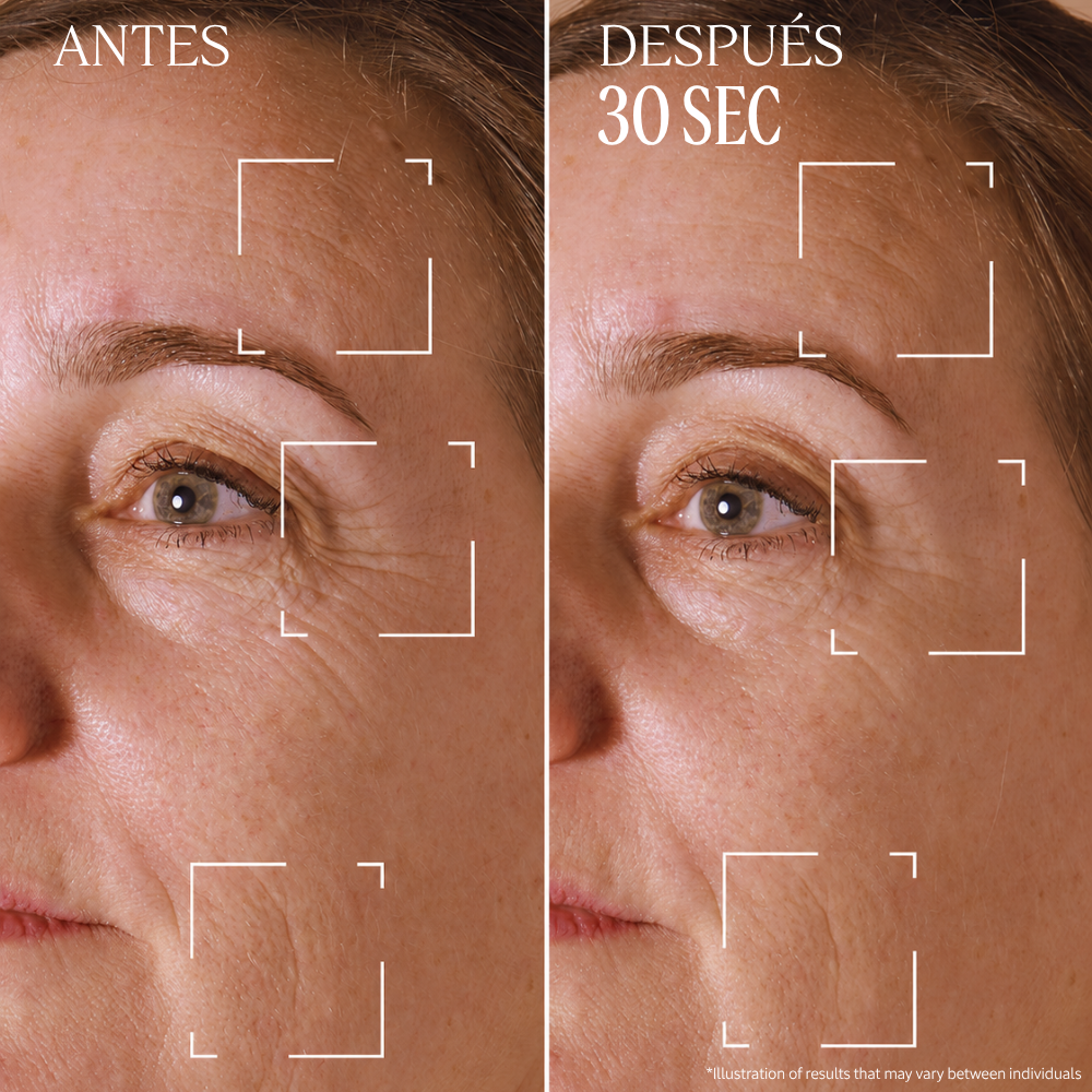 Tratamiento para Arrugas Localizadas Divina Immortelle