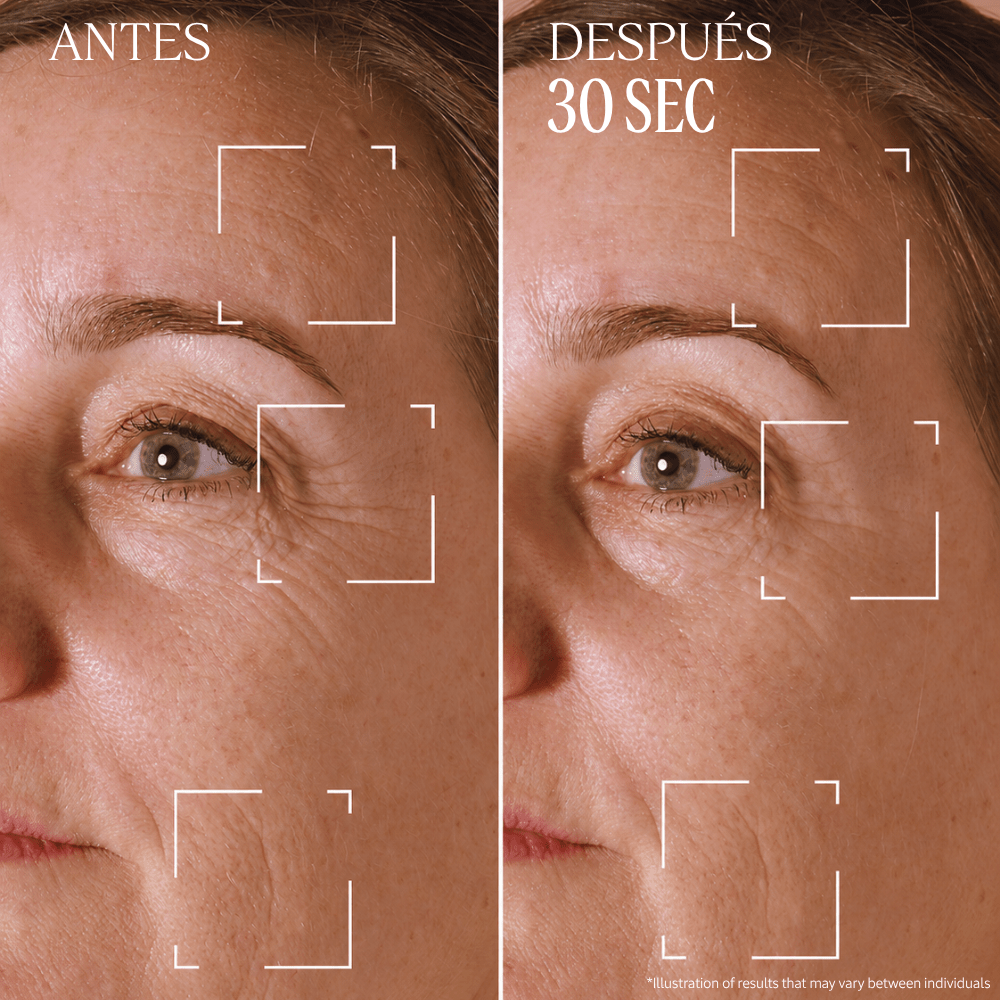 Tratamiento para Arrugas Localizadas Divina Immortelle